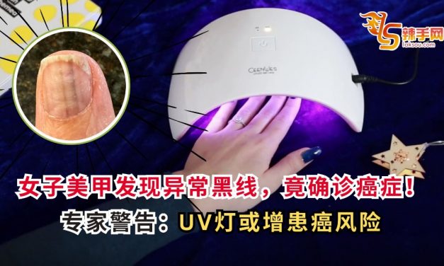 女子美甲发现异常黑线，竟确诊癌症！专家警告：UV灯或增患癌风险